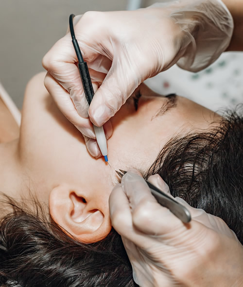 electrolysis